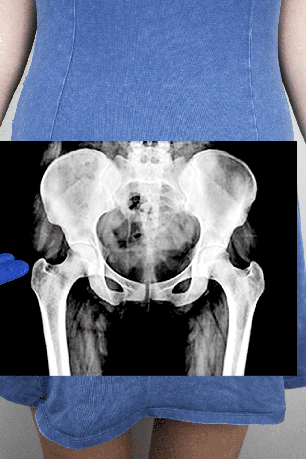 An Expert’s Guide To Dealing With Leaking Urine While Running