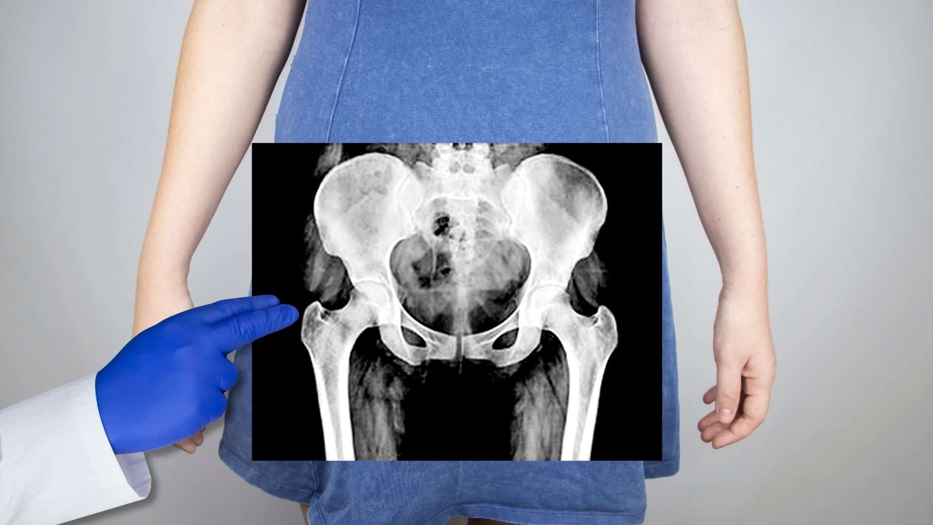 An Expert’s Guide To Dealing With Leaking Urine While Running